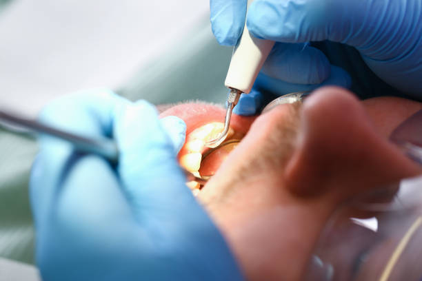 Best Emergency Dental Care for Sports Injuries in Edwards Af, CA